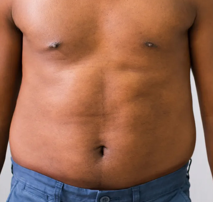 A person with a bare torso wearing blue pants, showing their midsection.