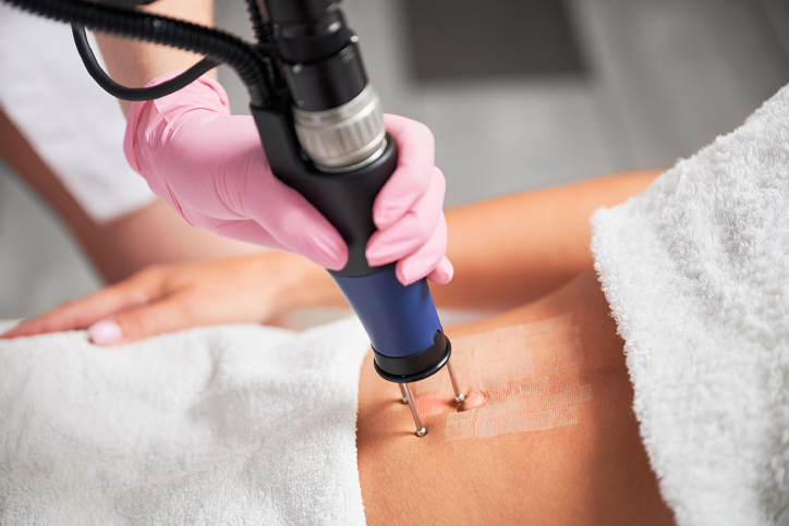 Medical professional performing laser skin treatment on patient.