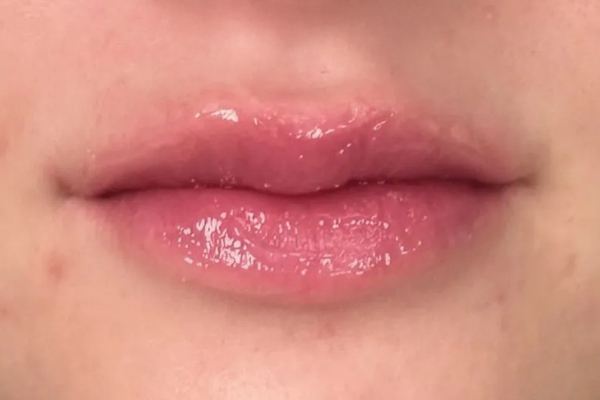 Close-up of shiny lips with clear gloss applied.