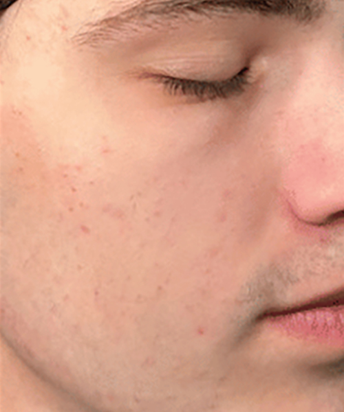 Close-up of a person's face with closed eyes and slight facial hair.