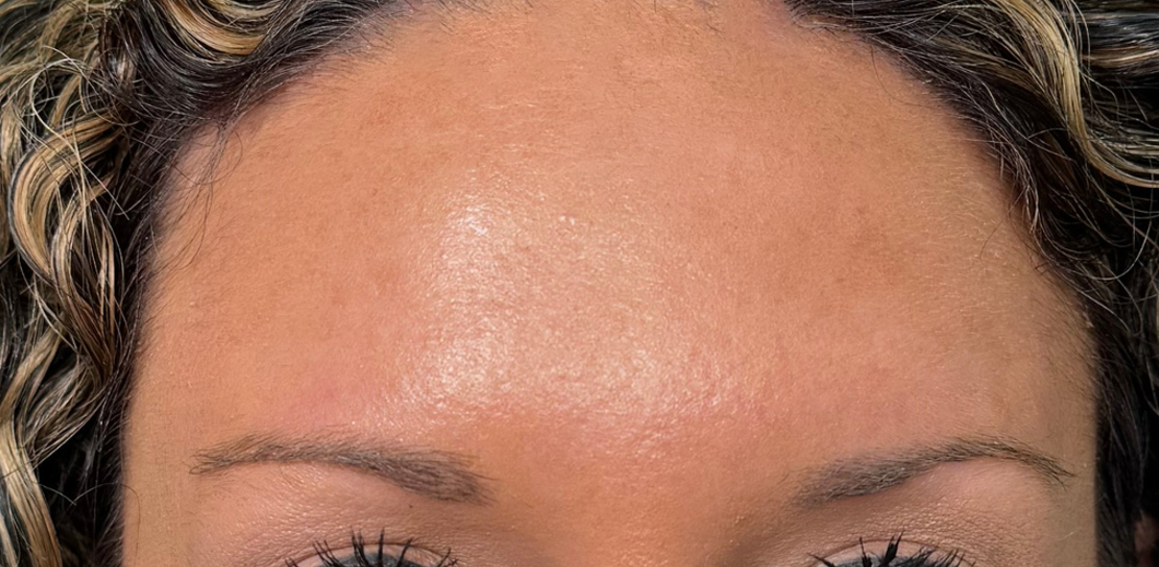 Close-up of a woman's forehead and eyebrows with curly hair.