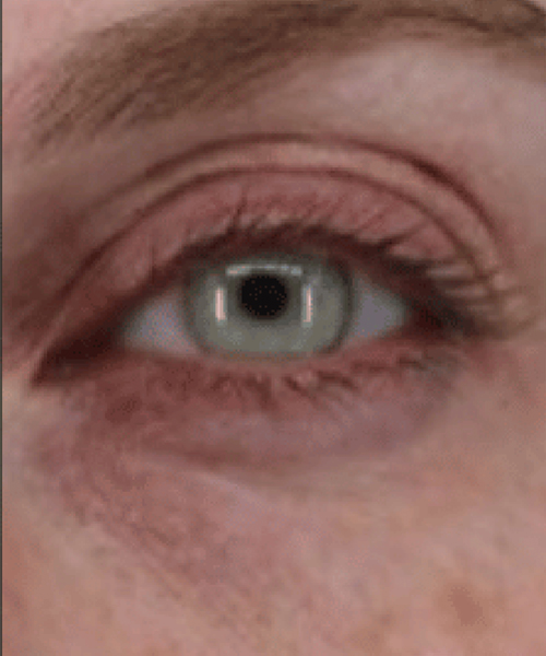 Close-up of a human eye with green iris and natural skin tones.