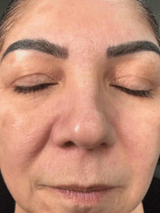 Close-up of a person's face with eyes closed, showing detailed skin texture.
