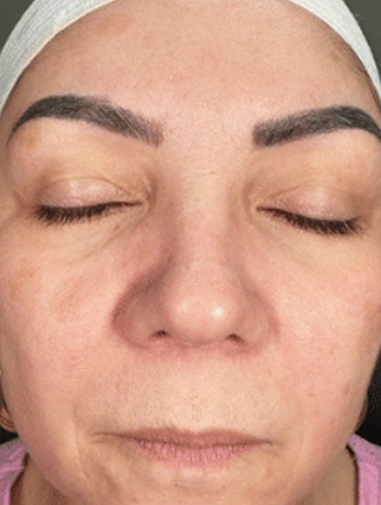 A woman's face with closed eyes and a headband, showing tattooed eyebrows.