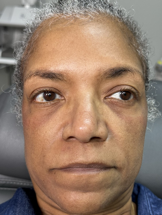 A person with curly gray hair and a neutral expression is looking slightly to the side.