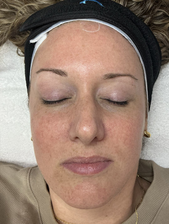 A woman lying down with closed eyes, wearing a headband.