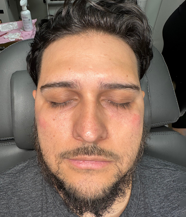 A man with closed eyes reclines on a chair in a clinic setting.