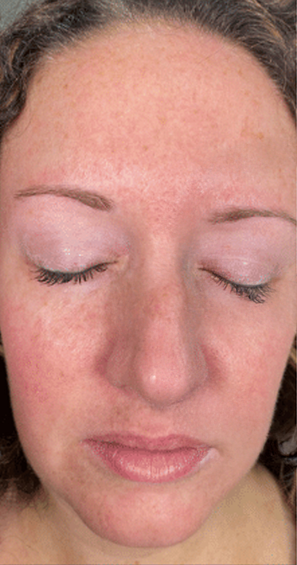 A person with closed eyes and clear skin, showing facial features.