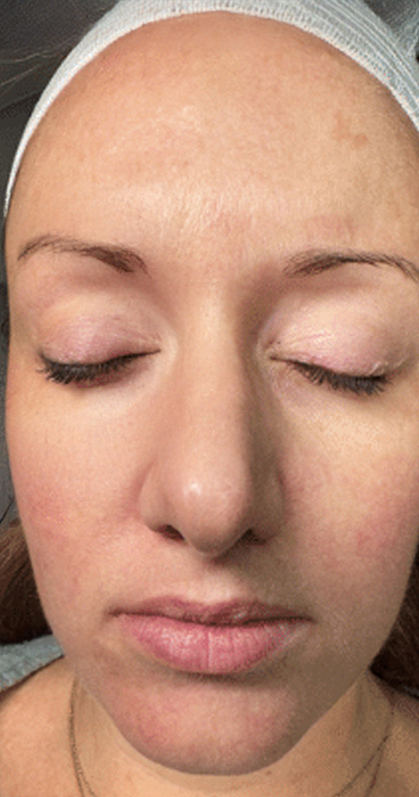 Close-up of a woman's face with eyes closed and wearing a headband.