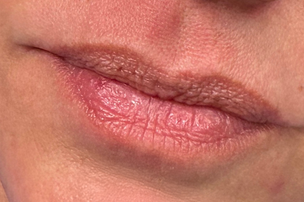 Close-up of a person's lips with natural texture and color.