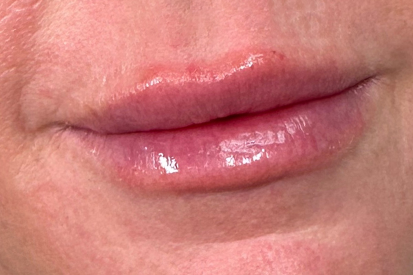 Glossy lips with a subtle sheen.