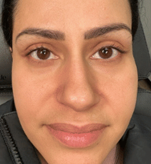 A person with dark eyes and brows, wearing a jacket, close-up face image.