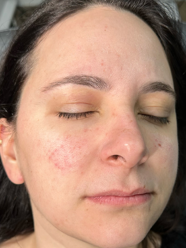 Close-up of a woman's face with closed eyes and visible skin texture.