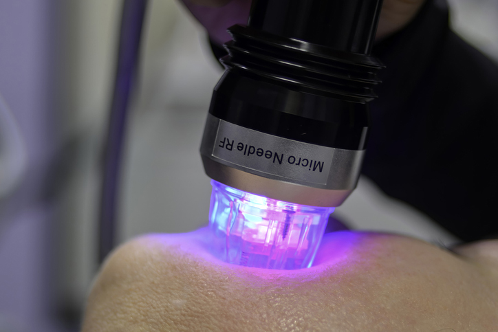 Device performing microneedle RF skin treatment with glowing LED lights.
